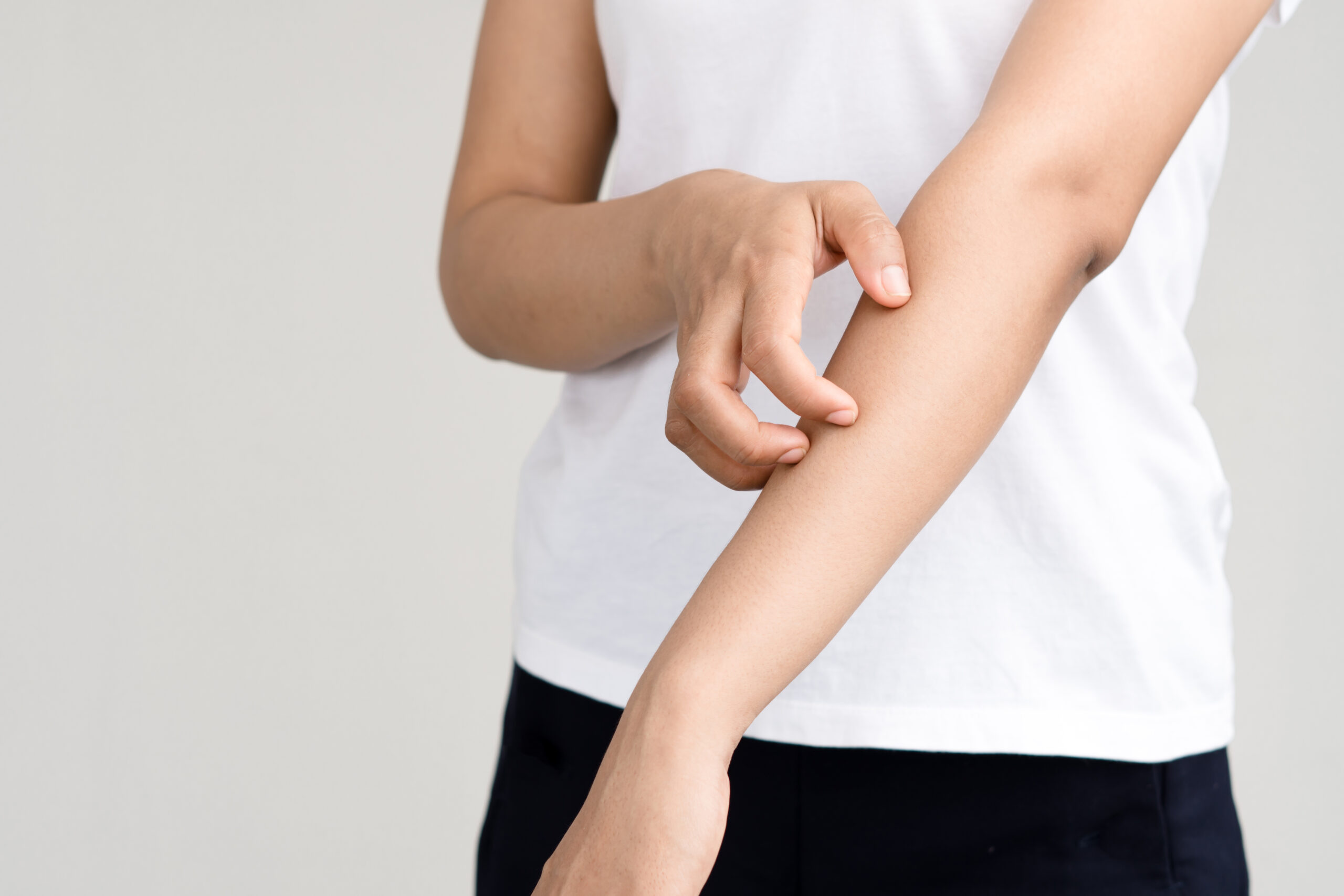 Beratung bei Hautproblemen, Rathaus Apotheke Hamburg